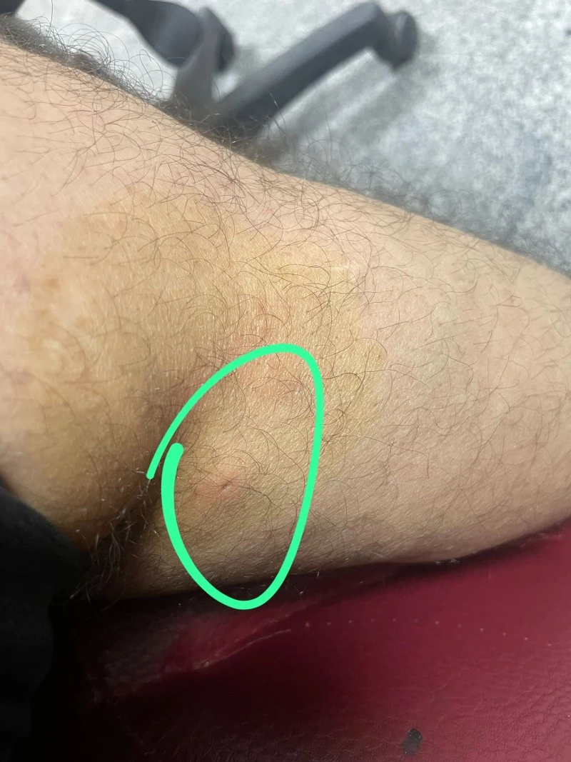 a