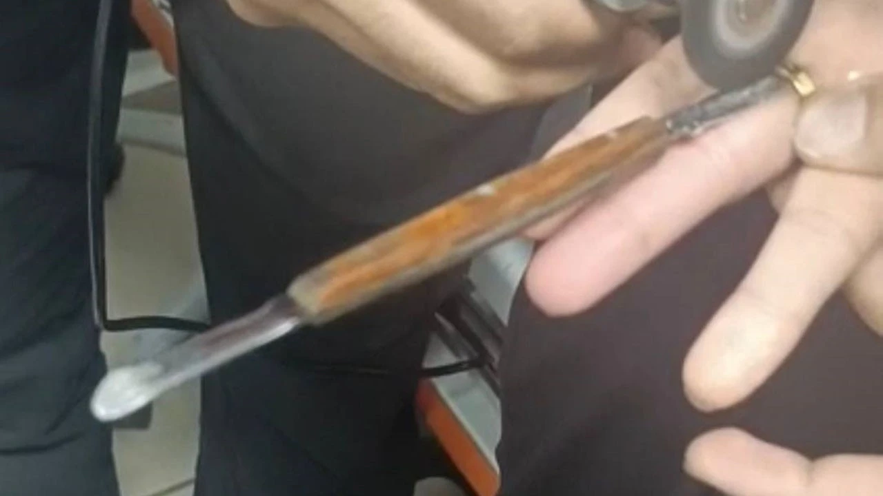 PARMAĞINA SIKIŞAN Y&Uuml;Z&Uuml;Ğ&Uuml; İTFAİYE KESTİ
