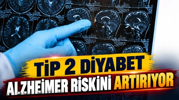 TİP 2 DİYABET ALZHEİMER RİSKİNİ ARTIRIYOR
