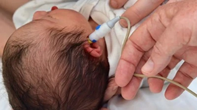 1 MİLYON &Ccedil;OCUĞA İŞİTME TESTİ