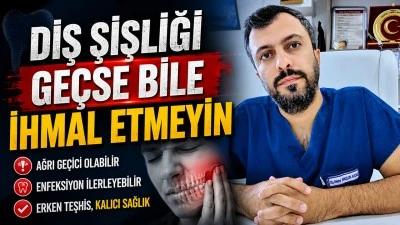 DİŞ ŞİŞLİĞİ GE&Ccedil;SE BİLE İHMAL ETMEYİN
