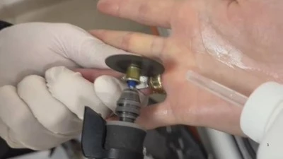 PARMAĞINDAKİ YÜZÜK İTFAİYE MÜDAHALESİYLE ÇIKARILDI