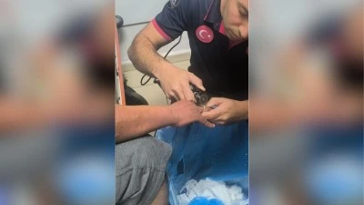 SIKIŞAN YÜZÜK HASTANEDE ÇIKARILDI