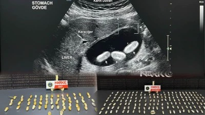 4 YOLCUNUN MİDESİNDEN &Ccedil;IKANLAR AĞIZLARI A&Ccedil;IK BIRAKTI!