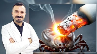 KENENİN ÜZERİNE SİGARA BASMAYIN