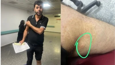 GAZETEMİZ YAZARI EKREM TURGUT’U KENE ISIRDI