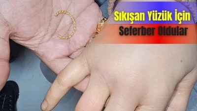 PARMAĞINA SIKIŞAN Y&Uuml;Z&Uuml;K HASTANEDE &Ccedil;IKARILDI