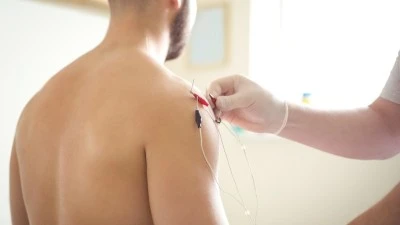 SİGARAYI BIRAKMAK İSTEYENLERE AKUPUNKTUR DESTEĞİ