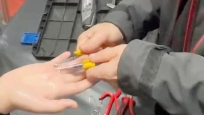 SANİYELERLE YARIŞTILAR, PARMAK KURTARILDI