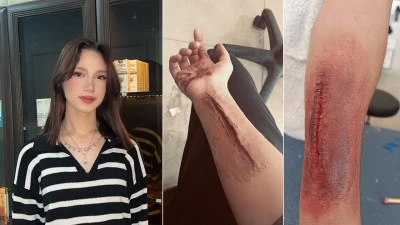 İLK BAKIŞTA KAN DONDURUYOR&hellip; GER&Ccedil;EK Mİ?