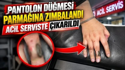 PANTOLON D&Uuml;ĞMESİ PARMAĞINA ZIMBALANDI