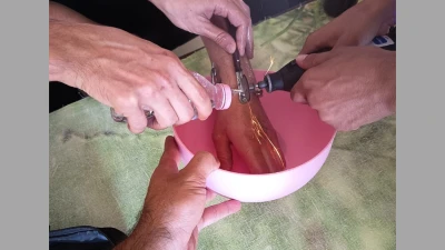 ELİNE METAL CİSİM SIKIŞTI