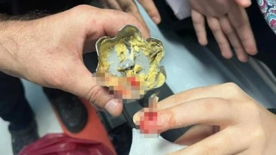 MUTFAKTA KAZA: PARMAĞI BLENDER’A SIKIŞTI