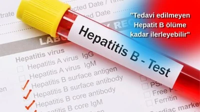 HEPATİT B UYARISI: &ldquo;ERKEN TEŞHİS HAYAT KURTARIR&rdquo; 