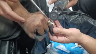 HASTANEDE YÜZÜK OPERASYONU