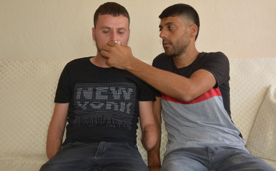 Protez kolları için yardım bekliyor