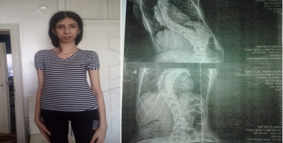 SİNEMGÜL, AMELİYATI İÇİN VALİ’YE SESLENDİ