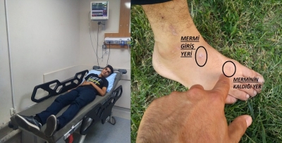 Vücudunda kurşunla dolaşıyor
