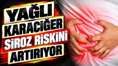 Yağlı Karaciğer Siroz Riskini Artırıyor